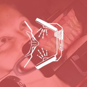 Iluminadores Bucales