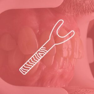 Retractores labiales